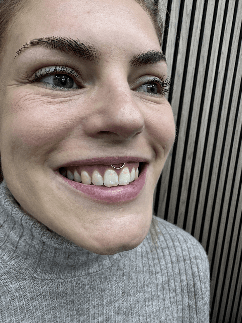 Smiley piercing professionelt udført i Horsens