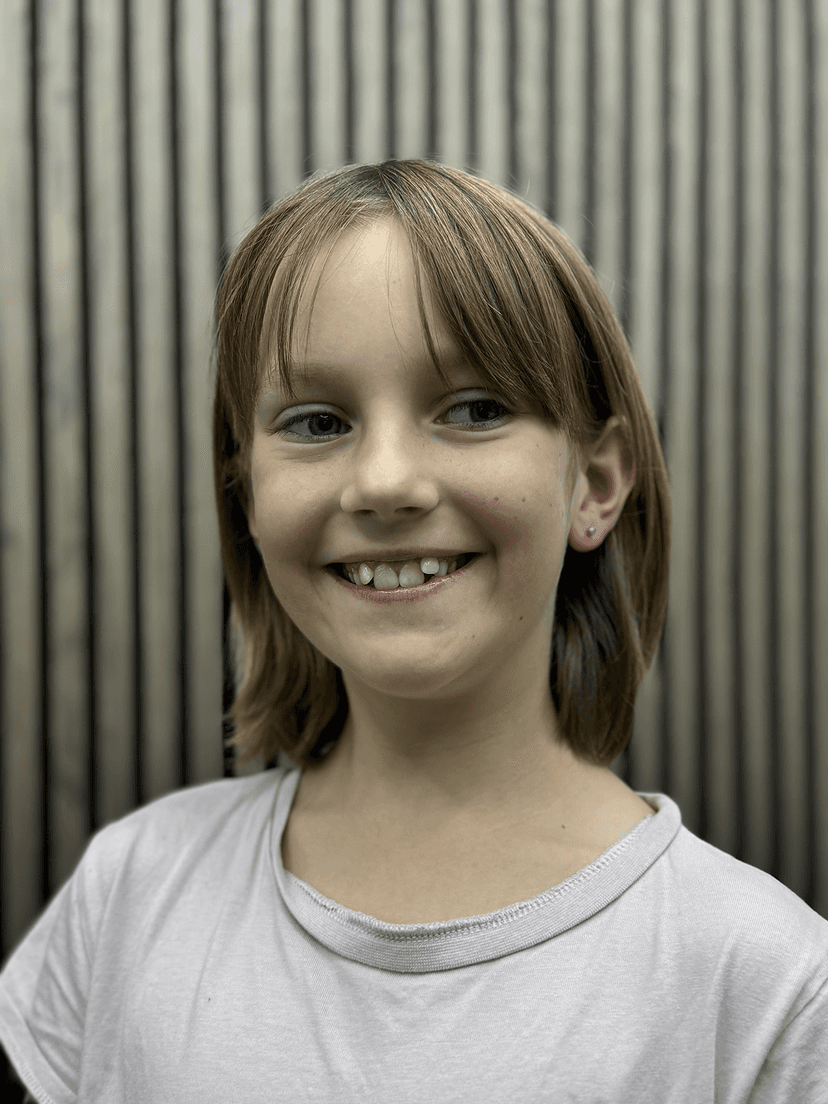 Smiley piercing professionelt udført i Horsens