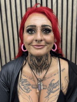 Smiley piercing professionelt udført i Horsens