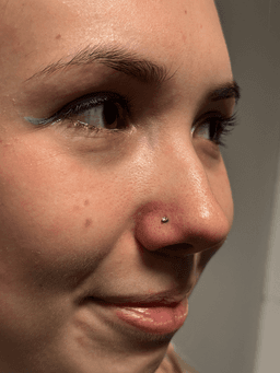 Smiley piercing professionelt udført i Horsens