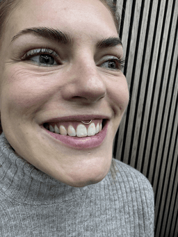 Smiley piercing professionelt udført i Horsens