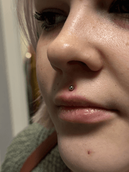 Smiley piercing professionelt udført i Horsens